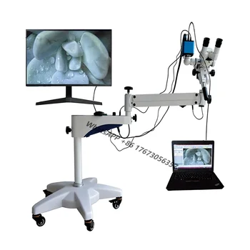 Цифровой эндоскоп для гинекологического обследования HD Видео Вагинальное для гинекологии Влагалище
